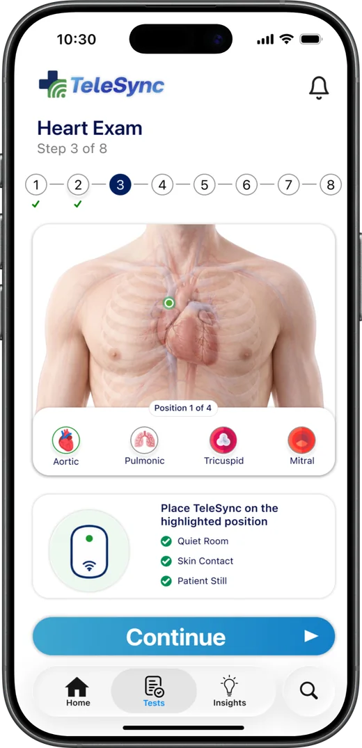Heart exam screen showing placement positions on the chest
