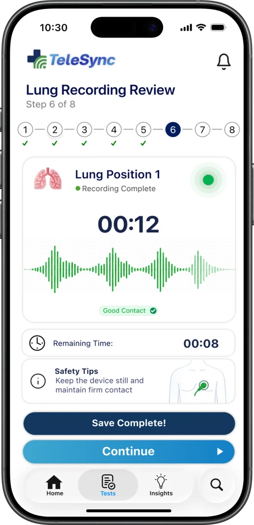 Lung recording review with waveform